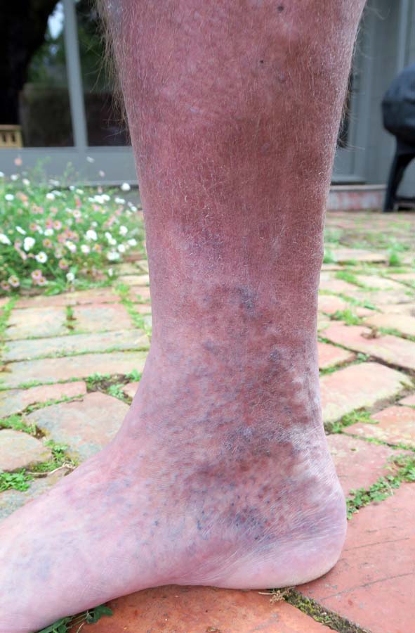 2016 Brian Wilson's Right Leg